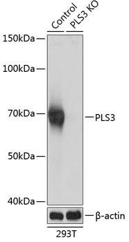 Anti-PLS3 Antibody (CAB19956)[KO Validated]