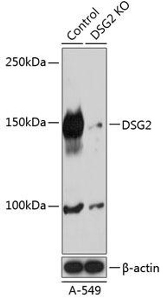 Anti-DSG2 Antibody (CAB19996)[KO Validated]