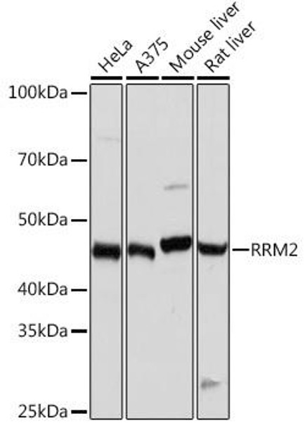 Anti-RRM2 Antibody (CAB3424)