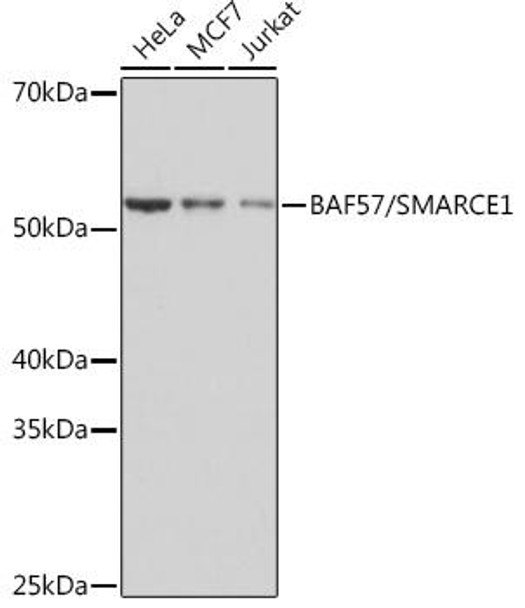 Anti-BAF57/SMARCE1 Antibody (CAB3814)