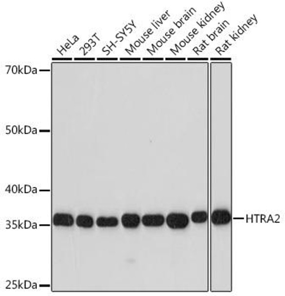 Anti-HTRA2 Antibody (CAB3904) Anti-HTRA2 Antibody (CAB3904)