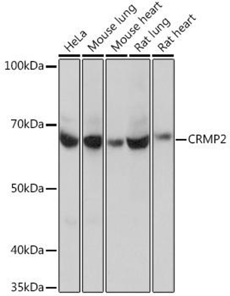 Anti-CRMP2 Antibody (CAB4411)