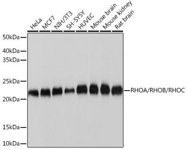 Anti-RHOA/RHOB/RHOC Antibody (CAB4855)