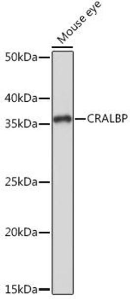 Anti-CRALBP Antibody (CAB9265)