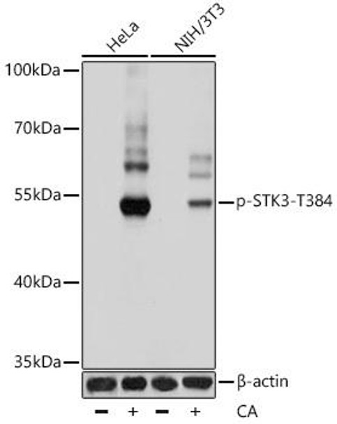 Anti-Phospho-STK3-T384 Antibody (CABP0935)