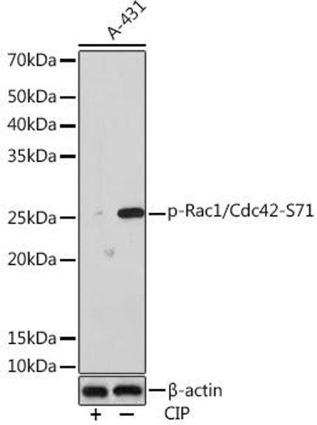 Anti-Phospho-Rac1/Cdc42-S71 Antibody (CABP1018)