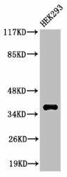 Cleaved-MMP23A (Y79) Antibody (PACO00036)