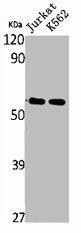 TRIM68 Antibody (PACO01800)