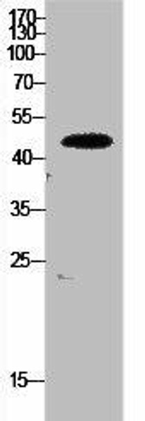 EEF1A1/EEF1A2/EEF1A1P5 Antibody (PACO02169)