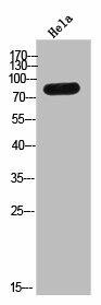 TMC8 Antibody (PACO02507)