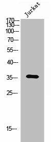 OR6Q1 Antibody (PACO02697)