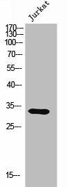 OR9Q1 Antibody (PACO02698)