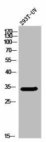 OR5W2 Antibody (PACO02861)