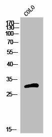 OR5H15 Antibody (PACO02883)