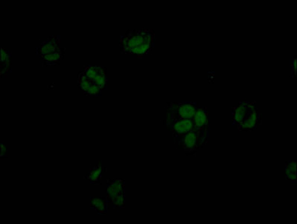 Anti-STAG2 Antibody (RACO0394)