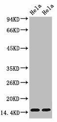 Anti-Tri-methyl-Histone H3(K36) Antibody (MACO0062)