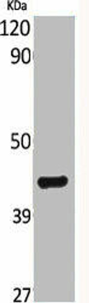BRS3 Antibody (PACO06300)