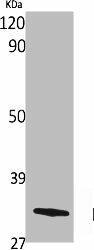 OR10G4 Antibody (PACO06709)