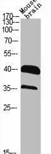 RRAGA/RRAGB Antibody (PACO06793)