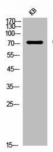 CD93 Antibody (PACO06893)