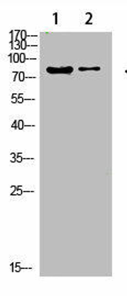 COL8A2 Antibody (PACO07443)
