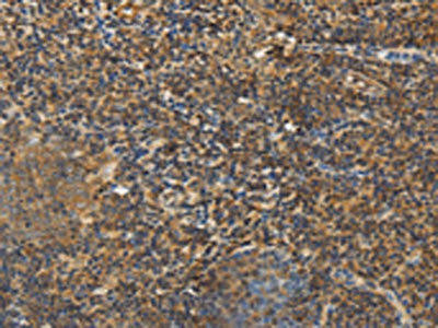 PCP4 Antibody (PACO13791)