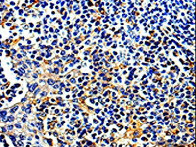 COX16 Antibody (PACO13907)