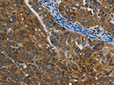 COX6B2 Antibody (PACO14280)