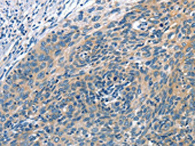 CUL7 Antibody (PACO14300)