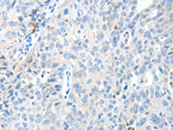 MAGEB4 Antibody (PACO14672)