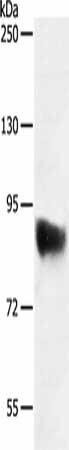 SEMA3G Antibody (PACO14973)