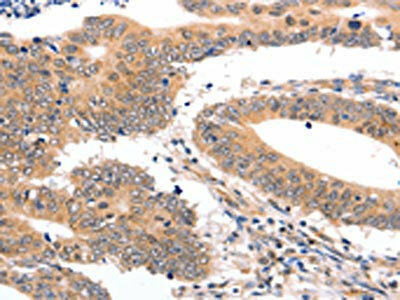 SEMA3G Antibody (PACO14974)
