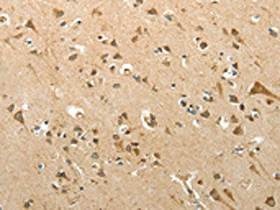 SLC12A4 Antibody (PACO14997)