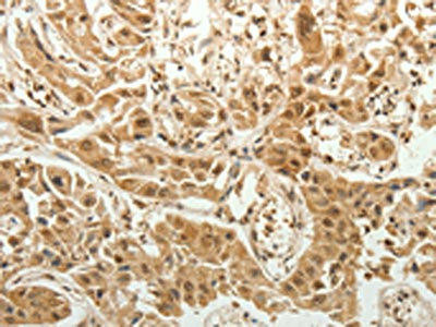 SPATA17 Antibody (PACO15064)