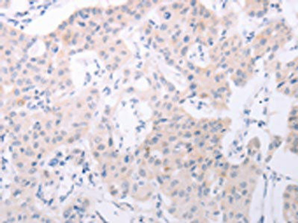 SPATA6 Antibody (PACO15160)