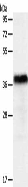 PGBD2 Antibody (PACO15204)
