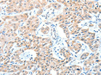 ADAM21 Antibody (PACO15312)