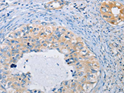 AGBL5 Antibody (PACO15343)
