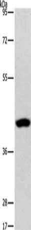 PHYKPL Antibody (PACO15356)