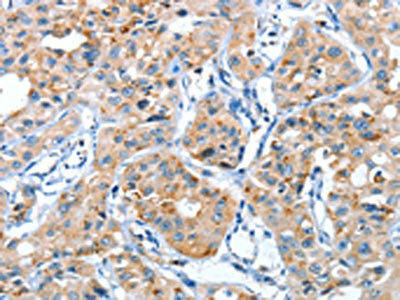 AUP1 Antibody (PACO15435)