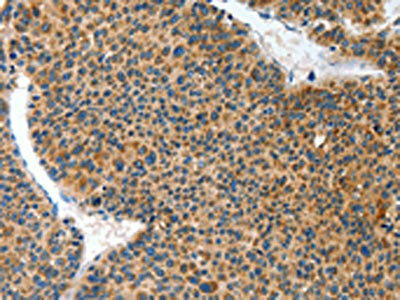 ANKRD54 Antibody (PACO15447)