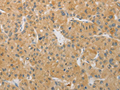 ARSK Antibody (PACO15561)
