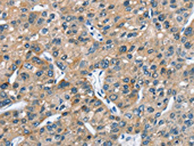 ARMCX2 Antibody (PACO15826)