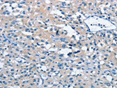 BTN2A2 Antibody (PACO15893)