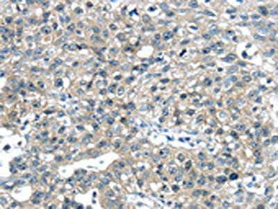 CENPM Antibody (PACO16010)