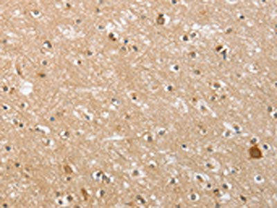 CTAGE5 Antibody (PACO16081)