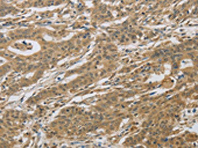 CYFIP2 Antibody (PACO16098)