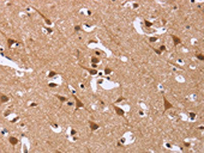 DCBLD2 Antibody (PACO16144)