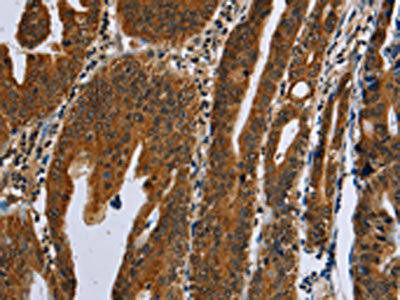 GH2 Antibody (PACO16412)