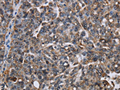 LDOC1 Antibody (PACO16610)